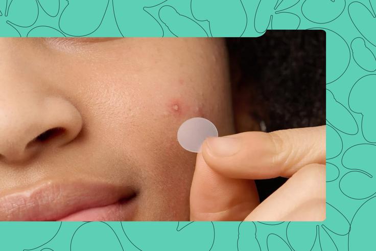 Nigerians Love These 5 Pimple Patches and So Will Your Skin