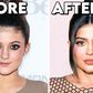 Before & After: 5 celebs whose plastic surgery transformed them completely