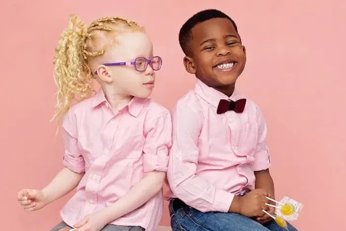 Fraternal twins with different skin tones; one child is Black and the other has albinism, illustrating genetic diversity and the possibility of different fathers.