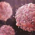 Cancer cases projected to rise 67% by 2050 as global diagnoses hit 34 million annually — here’s why