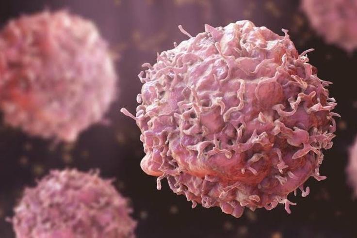 Cancer cases projected to rise 67% by 2050 as global diagnoses hit 34 million annually — here’s why