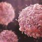 Cancer cases projected to rise 67% by 2050 as global diagnoses hit 34 million annually — here’s why