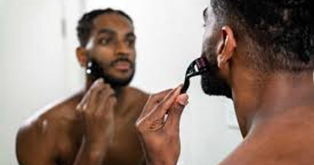 Do Derma Rollers Work for Beard Growth? Science-Based Truth