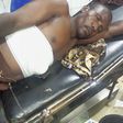 Police rush Abuja herbalist to hospital after shooting self while testing ‘bulletproof’ charm