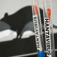 Hantavirus : aucun cas signalé au Sénégal