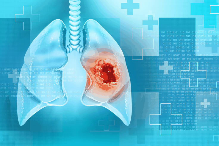 Cancer du poumon : ce symptôme matinal à ne jamais ignorer !