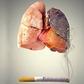 Cancer du poumon : au-delà du tabac, des risques souvent méconnus