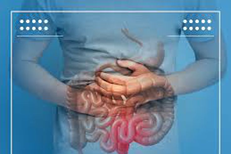 Le cancer du colon (cancer colorectal)