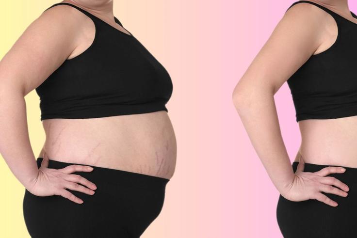 Cette inflammation cachée que votre ventre révèle chaque matin !