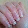 Santé : ces changements sur les ongles qu’il ne faut pas négliger