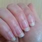 Santé : ces changements sur les ongles qu’il ne faut pas négliger