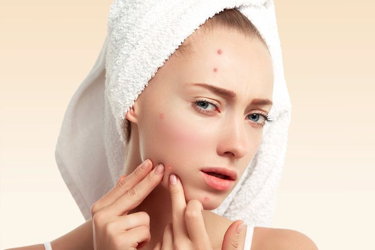 Ce bouton que vous ne devez jamais percer sur le visage