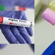 7 cas de Mpox, 277 cas de Fièvre de la vallée du RiftVR et 22 morts