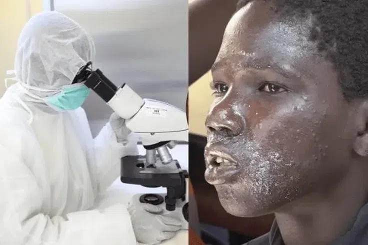 Sénégal : la cause de la maladie des pêcheurs identifiée 5 ans après