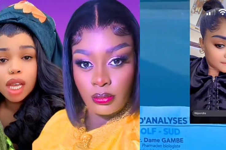 VIH/Sida : quand des célébrités sénégalaises jouent la carte de la transparence