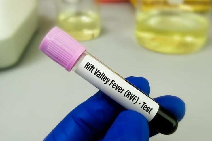 Fièvre de la Vallée du Rift : Comprendre le virus qui se transmet de l’animal à l’homme