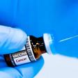 Un vaccin anticancer à l’essai : une baisse de 58 % du risque de récidive annoncée
