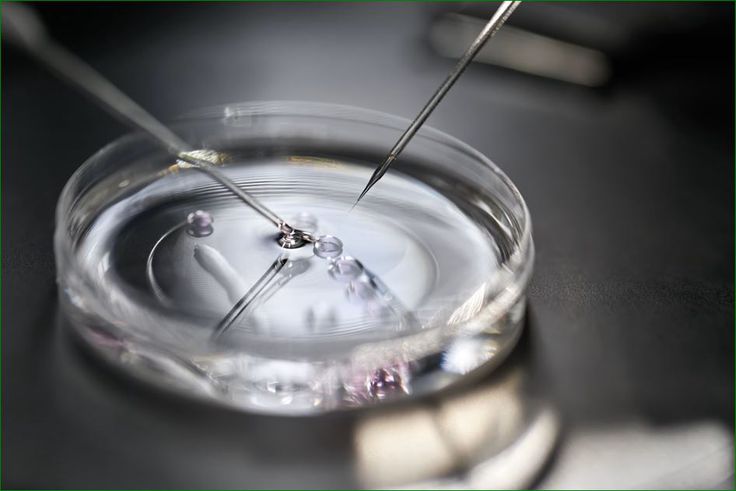 Mulago Hospital conducts first successful In Vitro Fertilisation