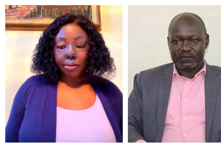 Makerere speaks out as senior lecturer’s ex-wife revives 15-year-old acid attack case