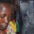 Woman remanded over forcing child to swallow needles