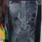Woman remanded over forcing child to swallow needles