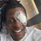 Chameleone undergoes surgery after ‘rapid loss of eyesight’
