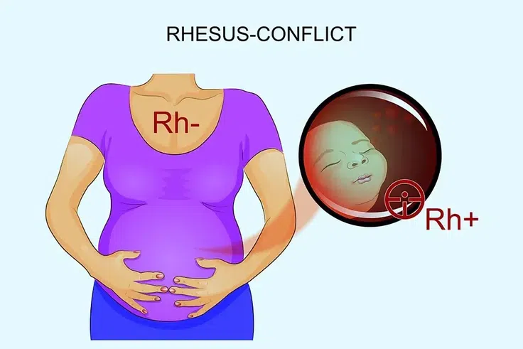 The RH Factor: How it can affect your pregnancy