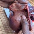 Why removing liver membrane before cooking makes all the difference