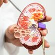 Health risks of living with a single kidney