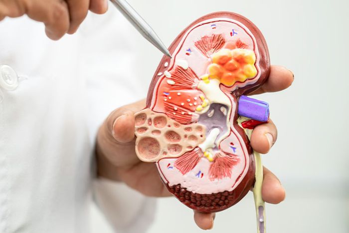 Health risks of living with a single kidney