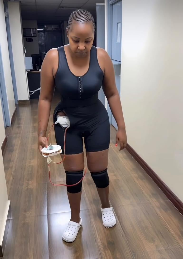Lydia Wanjiru underwent cosmetic surgery