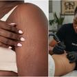Can tattoos hide stretch marks?: Skin-tone technique people are embracing