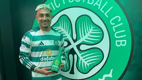¿Renace en Escocia? Julián Araujo, de Celtic, es elegido MVP del partido ante Falkirk