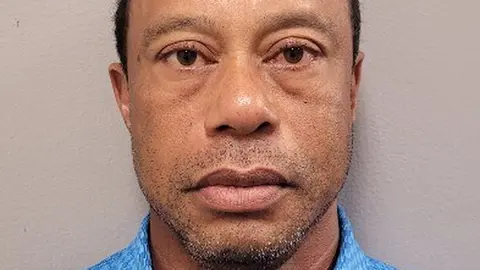 Woods mostró signos de deterioro tras el incidente |AP