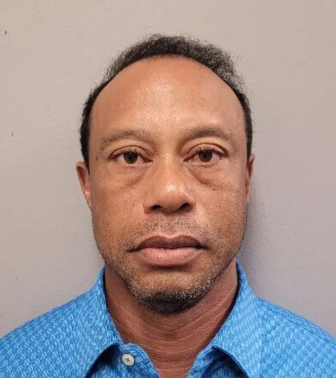 Woods mostró signos de deterioro tras el incidente |AP