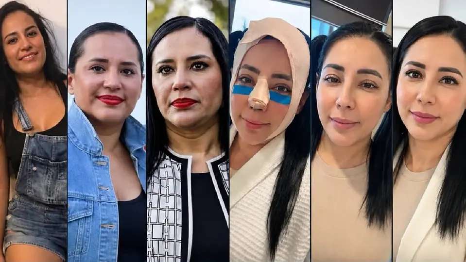 Así han sido los cambios que se ha hecho la empresaria Sandra Cuevas / Redes Sociales