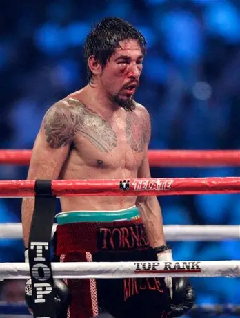 Tras su operación, Margarito ya quería entrenar