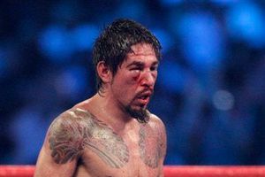 Hospitalizan a Margarito por fractura en el rostro, será operado el martes