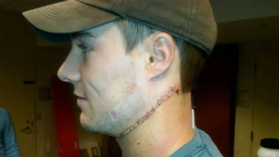 Jugador de Hockey casi muere degollado