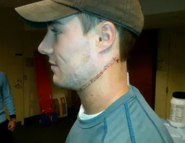 Jugador de Hockey casi muere degollado