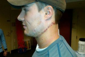 Jugador de Hockey casi muere degollado