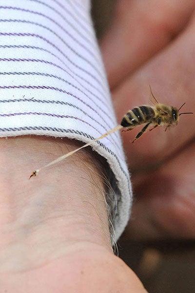 Una abeja deja su aguijón en el brazo de una persona | ESPECIAL