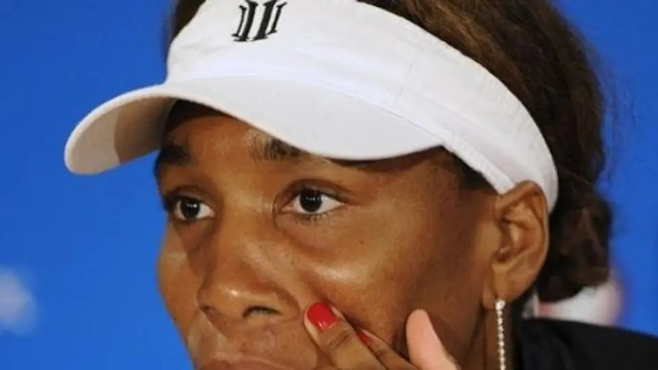Venus no jugará el Abierto de Miami