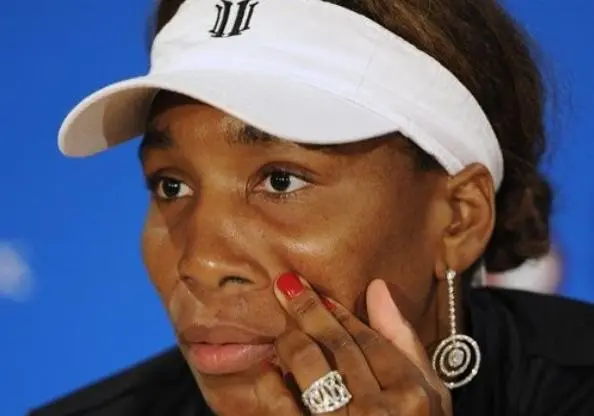 Venus no jugará el Abierto de Miami