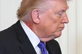 Marca roja en el cuello de Trump genera dudas sobre su salud y desata especulaciones en redes
