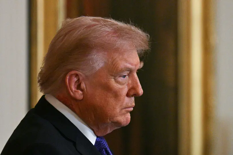 Hasta el momento, no existe un informe oficial que explique el origen de la marca visible en su cuello./ AFP