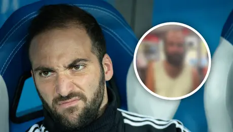 Gonzalo Higuaín y el sorprendente cambio físico que preocupa a la afición argentina