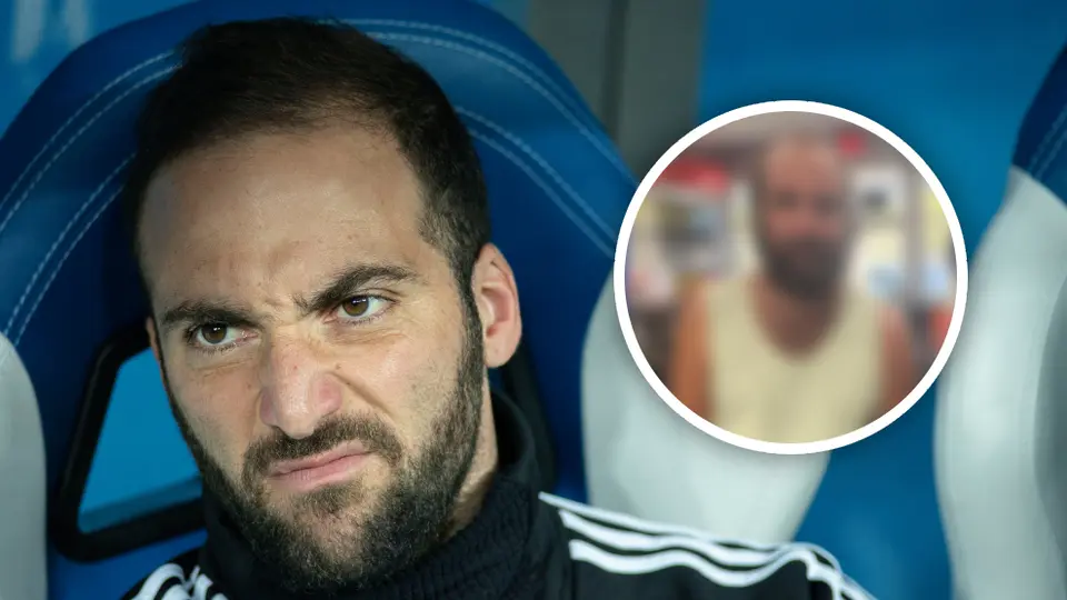 Gonzalo Higuaín y el sorprendente cambio físico que preocupa a la afición argentina