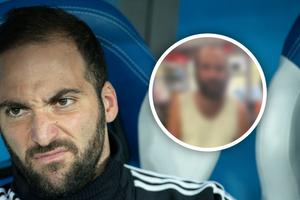 Gonzalo Higuaín y el sorprendente cambio físico que preocupa a la afición argentina