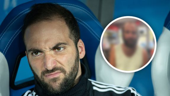 Gonzalo Higuaín y el sorprendente cambio físico que preocupa a la afición argentina